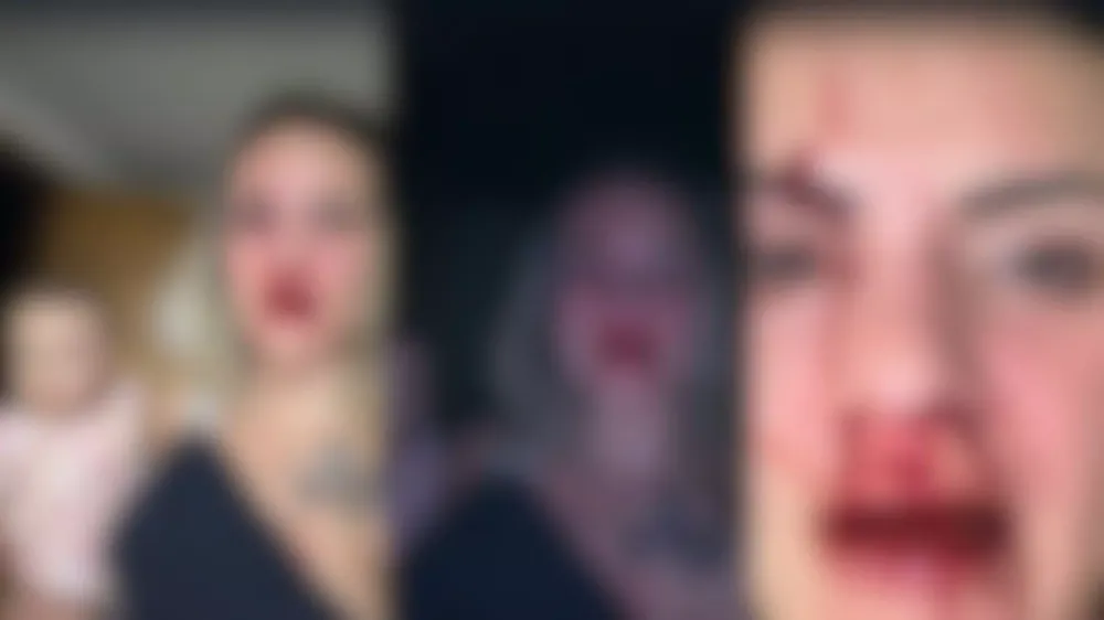 Músico que agrediu jornalista é liberado com tornozeleira em Campo Grande