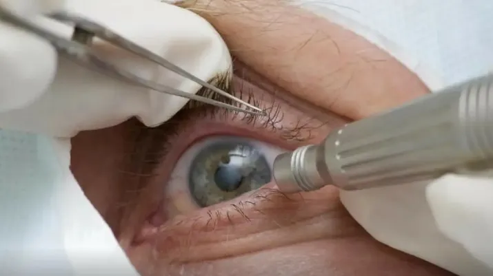 Medicamentos para perda de peso aumentam risco de danos oculares em pacientes diabéticos