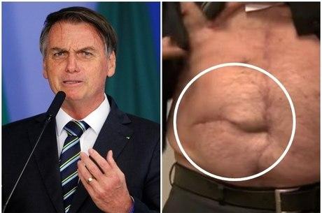 Bolsonaro passa por nova cirurgia em SP